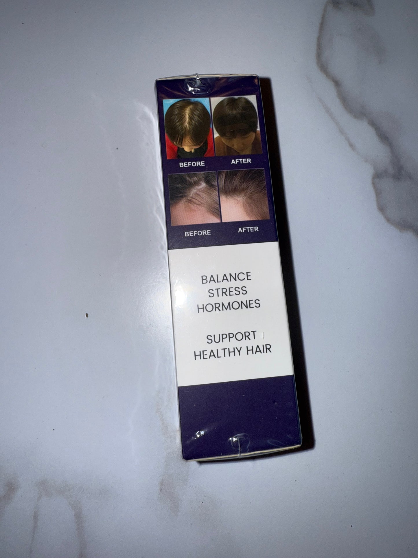 Ouhoe (1.7 fl/oz) Brand New Hair Growth Spray